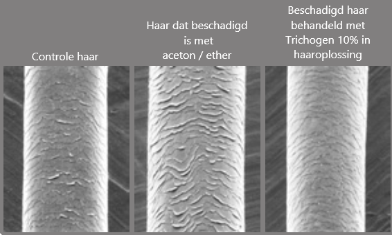 voor en na trichogen 10%